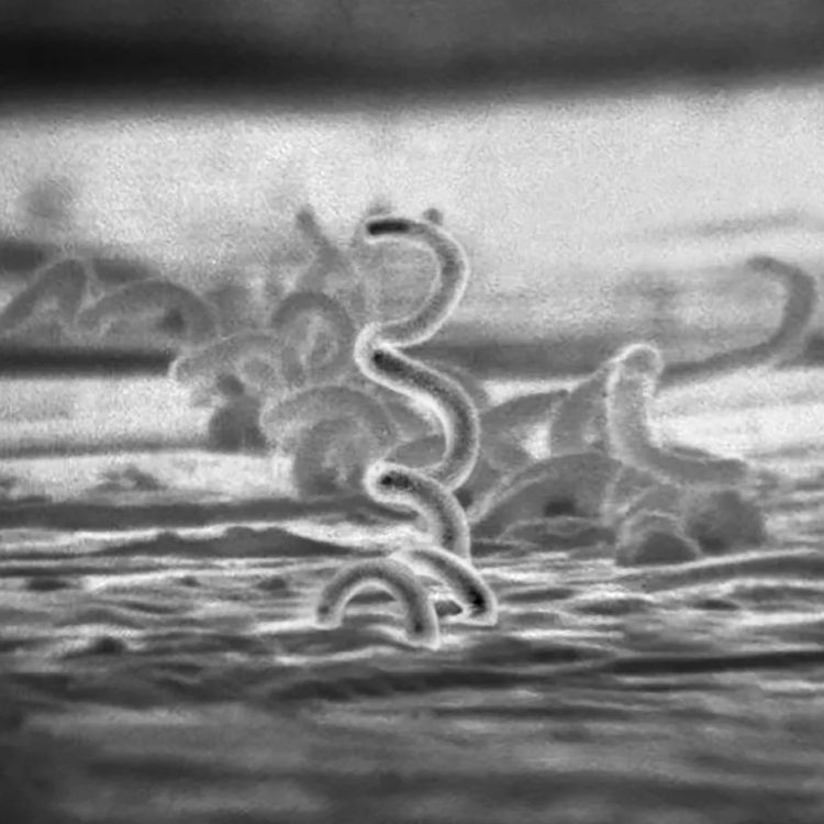 日本飙升的梅毒，到底是什么毒？