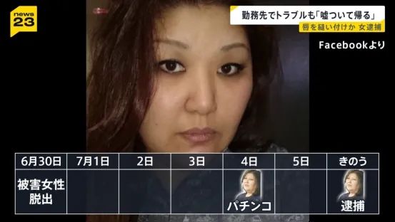 日本变态女子缝合室友双唇,竟是为了…?!电锯惊魂竟然在现实上演… 日本变态女子缝合室友双唇,竟是为了…?!电锯惊魂竟然在现实上演…