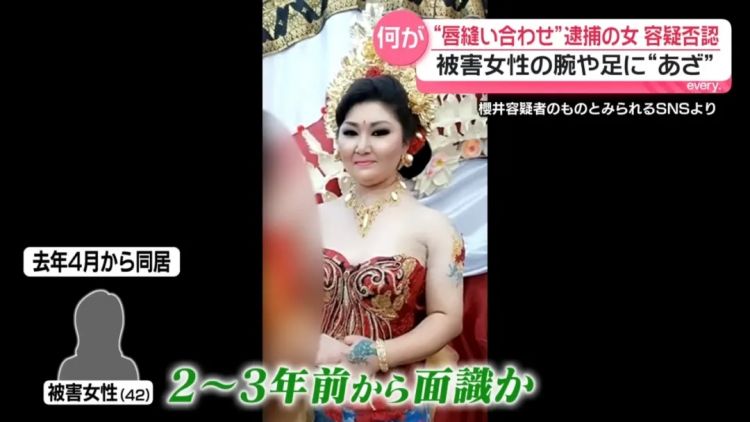 日本变态女子缝合室友双唇,竟是为了…?!电锯惊魂竟然在现实上演… 日本变态女子缝合室友双唇,竟是为了…?!电锯惊魂竟然在现实上演…